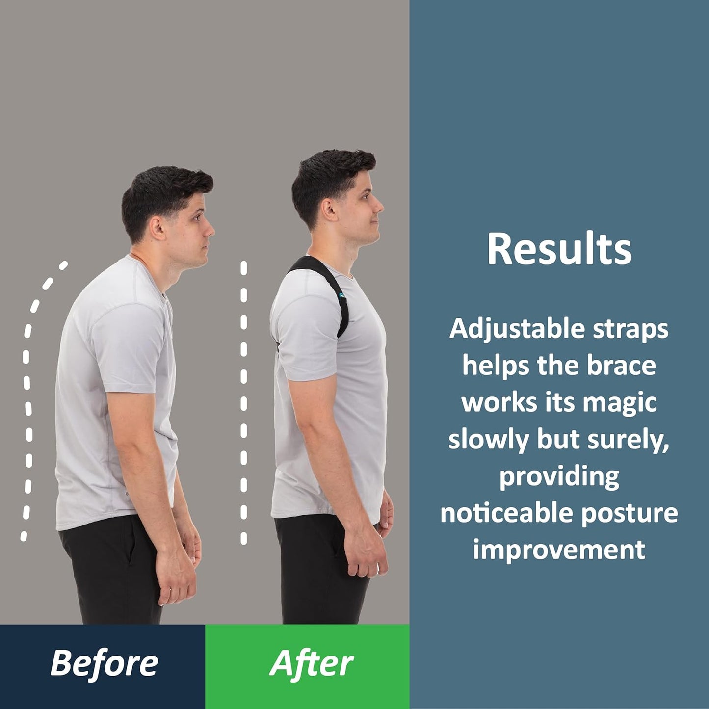 Posture Corrector